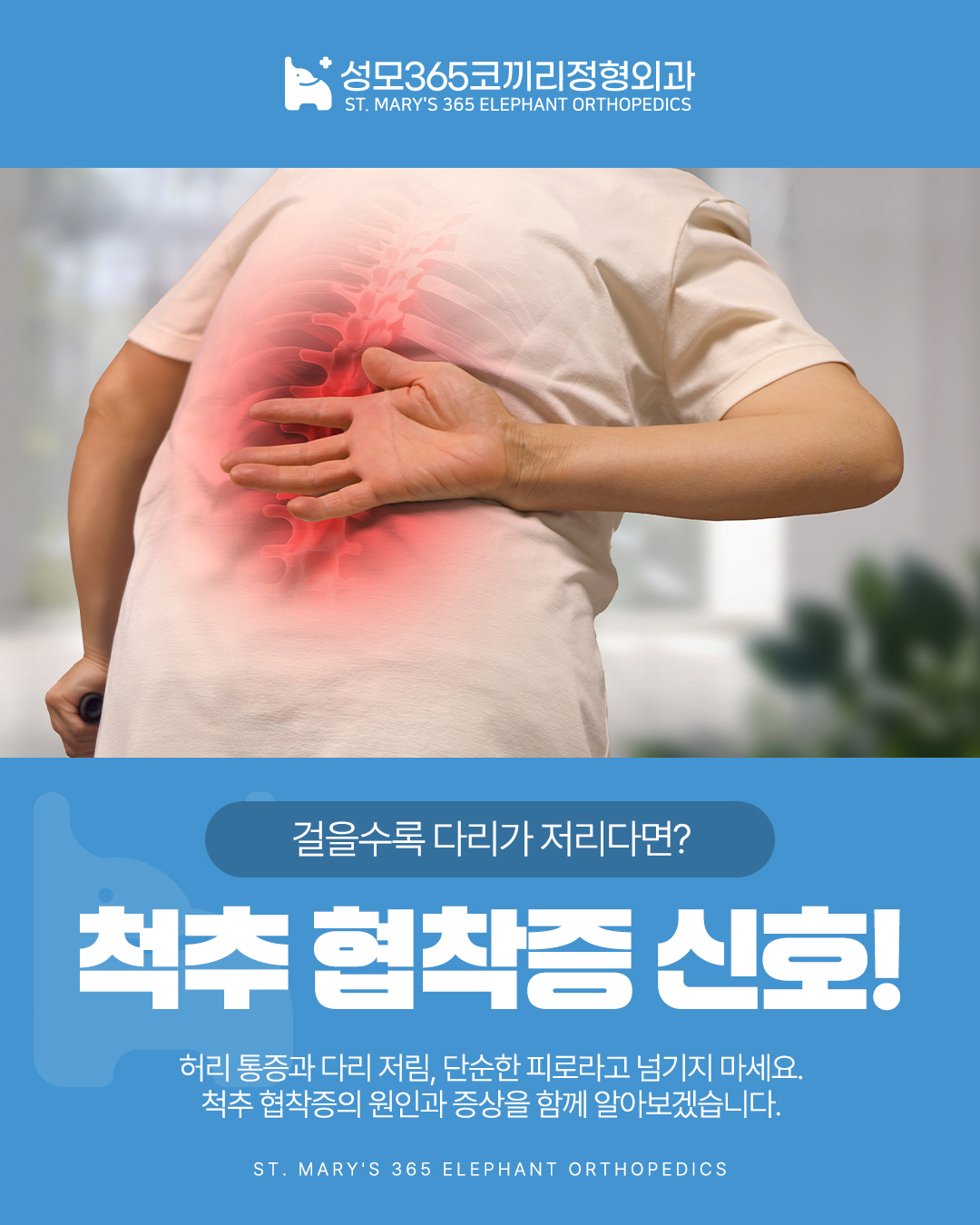 종암동 정형외과 척추협착증 증상, 오래 걸으면 다리가 저린 이유