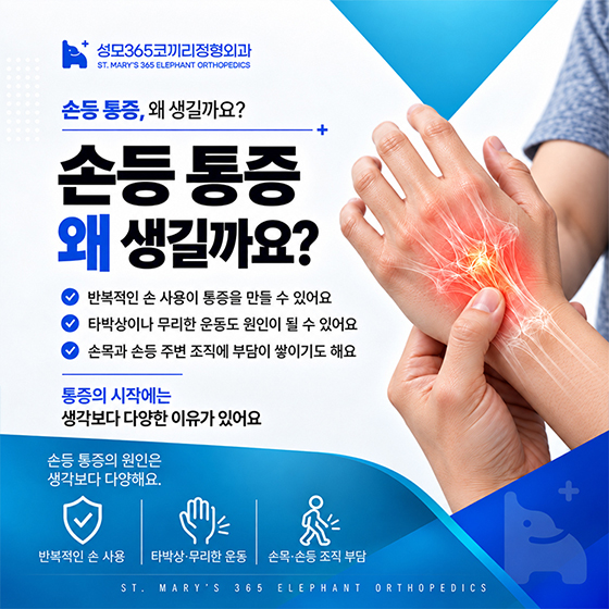 종암동 정형외과 어느날 손등이 당기는 느낌이 든다면?